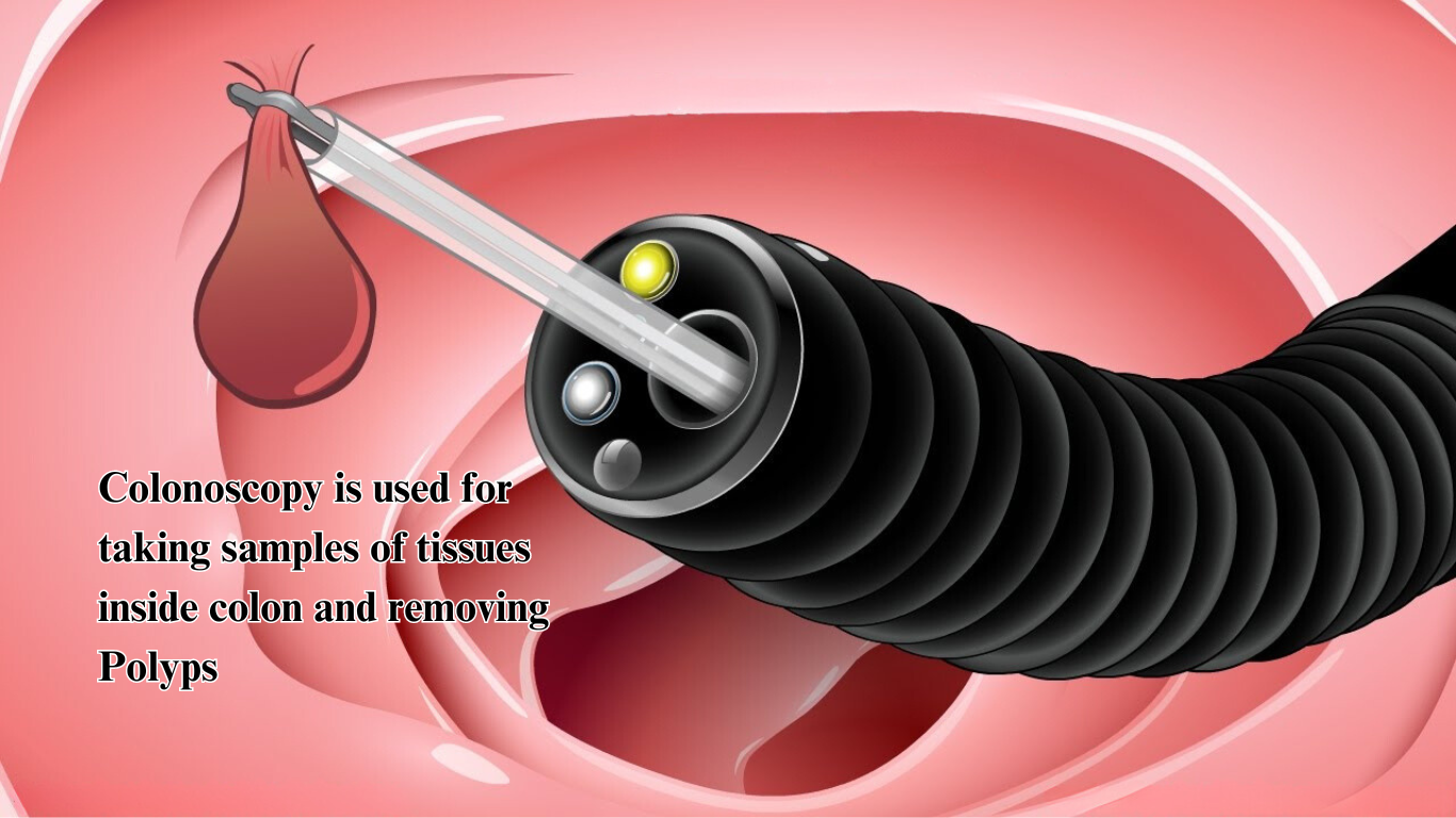 Colonoscopy In Pakistan: Procedure, Recovery And Cost - IGA