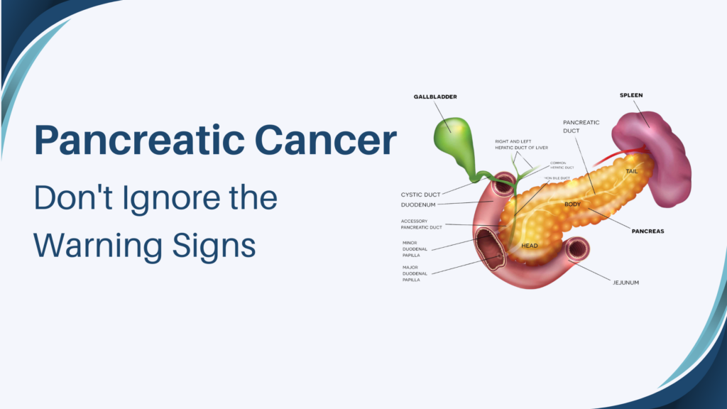 pancreatic cancer