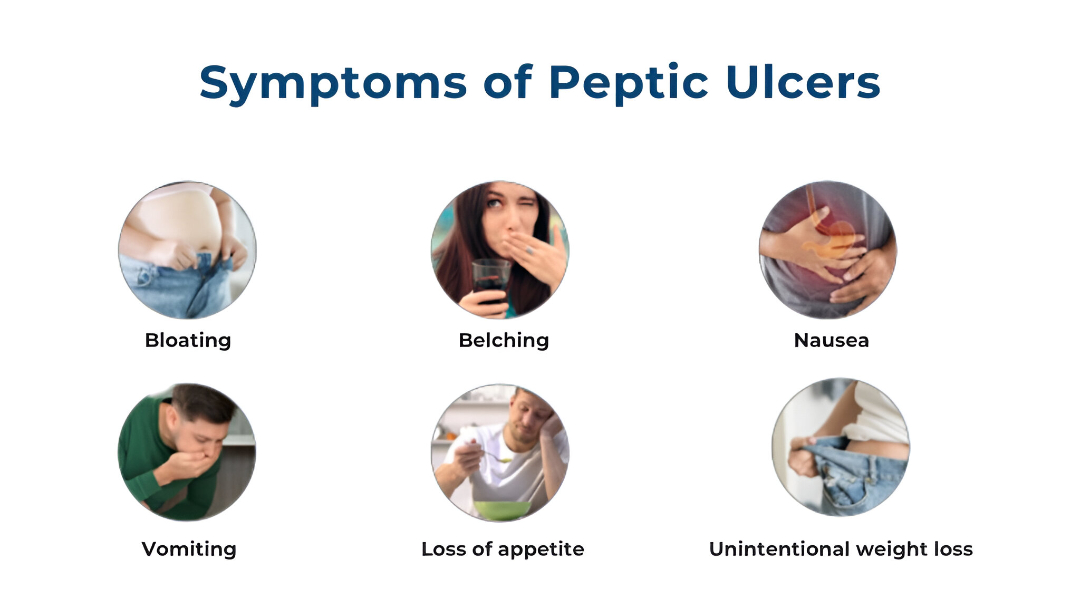 peptic ulcer