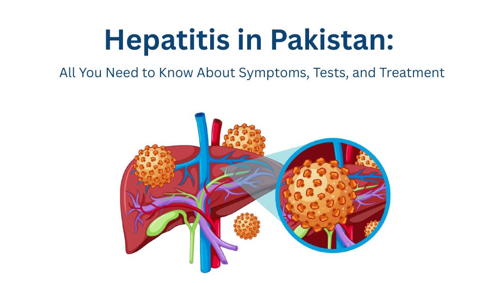 Hepatitis in Pakistan