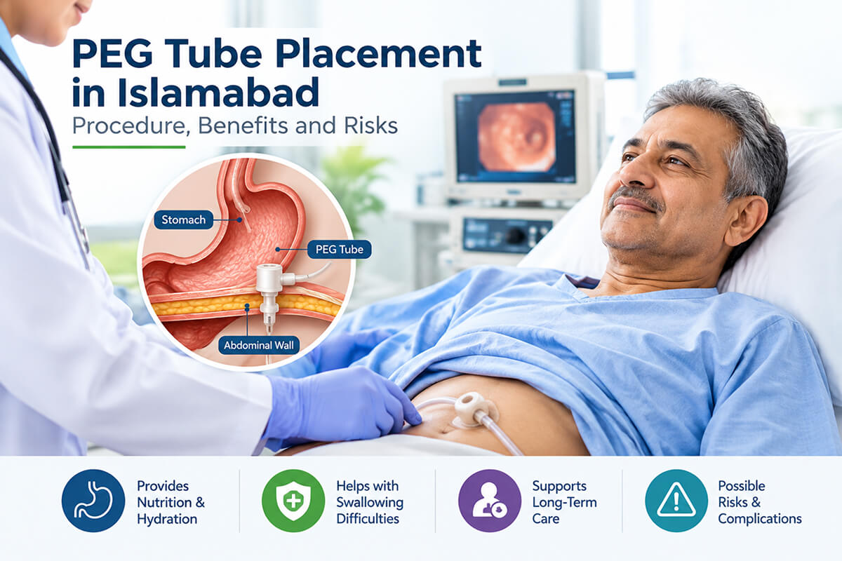 PEG tube placement for long-term nutritional support in Islamabad.