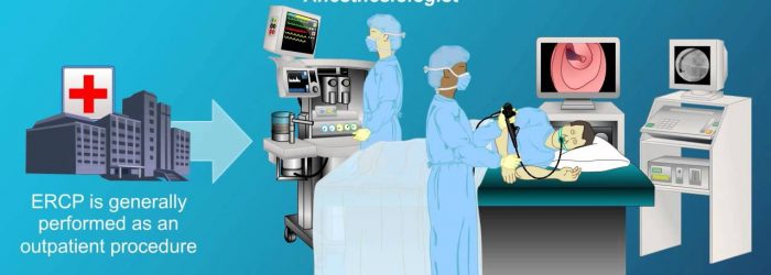 Endoscopic Retrograde Cholangiopancreatography