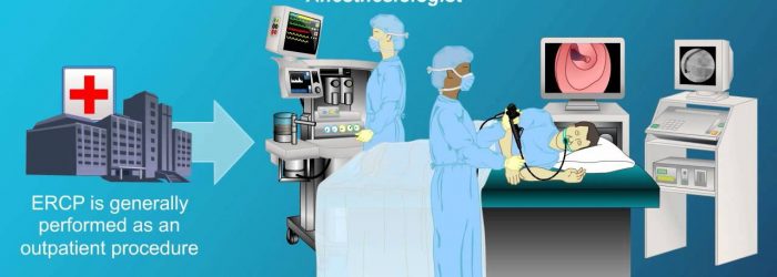 Endoscopic Retrograde Cholangiopancreatography